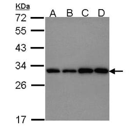 PGAM1 antibody from Signalway Antibody (22490) - Antibodies.com