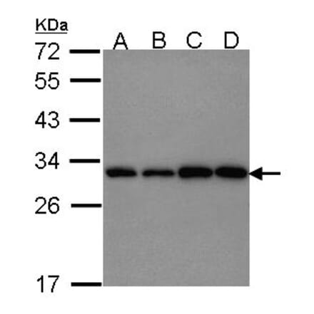 PGAM1 antibody from Signalway Antibody (22490) - Antibodies.com