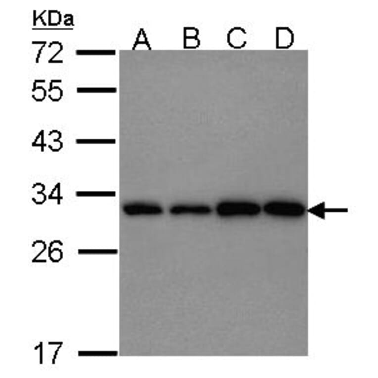 PGAM1 antibody from Signalway Antibody (22490) - Antibodies.com