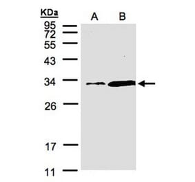 PITPN antibody from Signalway Antibody (22504) - Antibodies.com