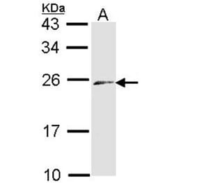 ET-3 antibody from Signalway Antibody (22579) - Antibodies.com