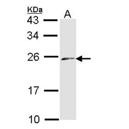 ET-3 antibody from Signalway Antibody (22579) - Antibodies.com