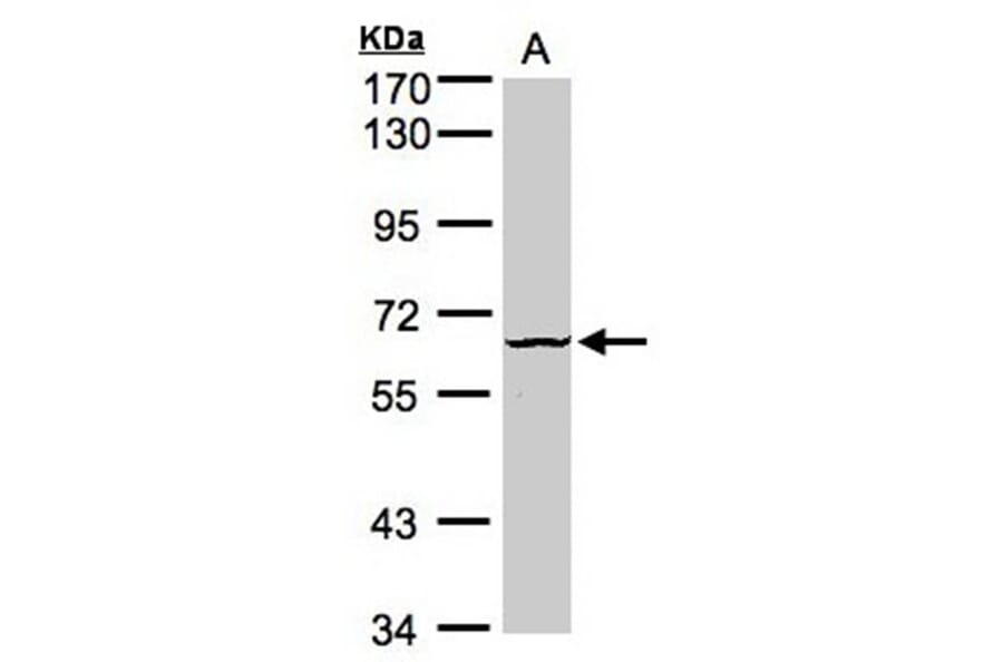 Dyrk3 antibody from Signalway Antibody (22581) - Antibodies.com