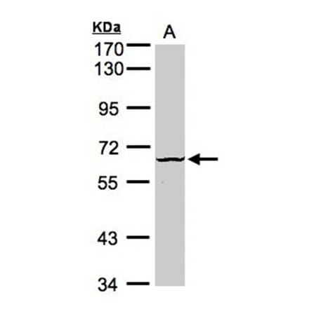 Dyrk3 antibody from Signalway Antibody (22581) - Antibodies.com