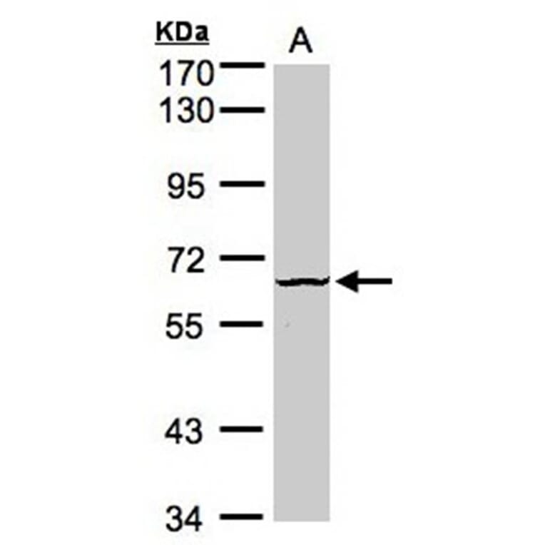Dyrk3 antibody from Signalway Antibody (22581) - Antibodies.com