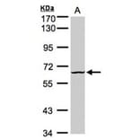 Dyrk3 antibody from Signalway Antibody (22581) - Antibodies.com