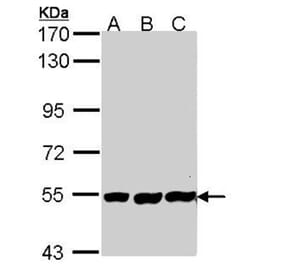 PLAP antibody from Signalway Antibody (22587) - Antibodies.com