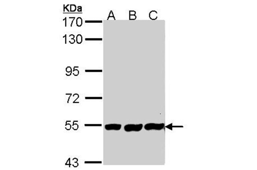 PLAP antibody from Signalway Antibody (22587) - Antibodies.com
