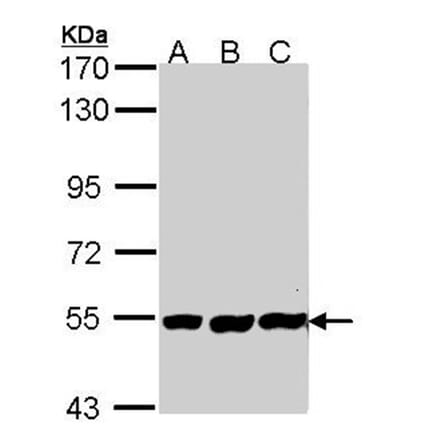 PLAP antibody from Signalway Antibody (22587) - Antibodies.com