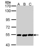 PLAP antibody from Signalway Antibody (22587) - Antibodies.com