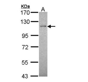 CtIP antibody from Signalway Antibody (22632) - Antibodies.com