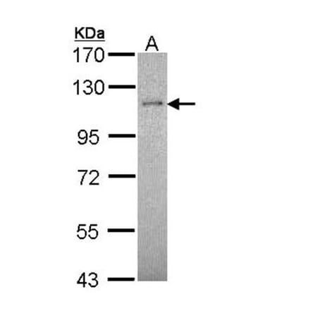 CtIP antibody from Signalway Antibody (22632) - Antibodies.com