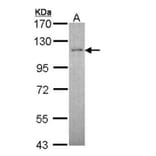 CtIP antibody from Signalway Antibody (22632) - Antibodies.com