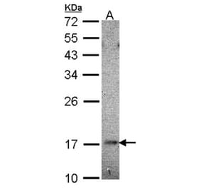 UBE2B antibody from Signalway Antibody (22642) - Antibodies.com