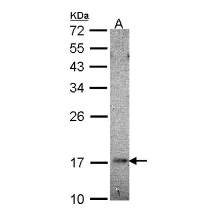 UBE2B antibody from Signalway Antibody (22642) - Antibodies.com