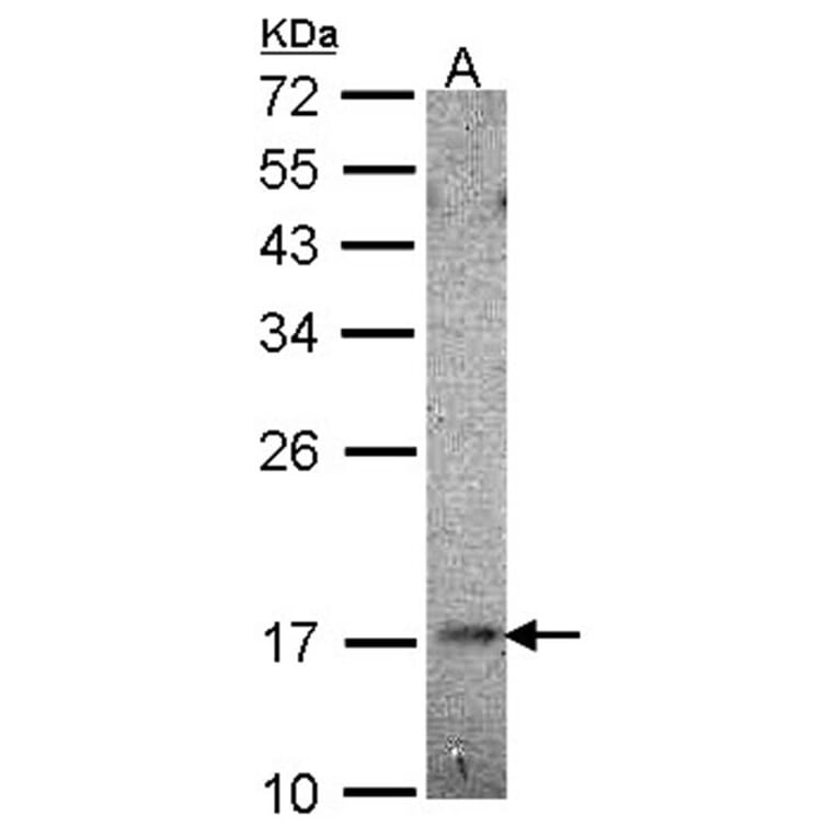 UBE2B antibody from Signalway Antibody (22642) - Antibodies.com