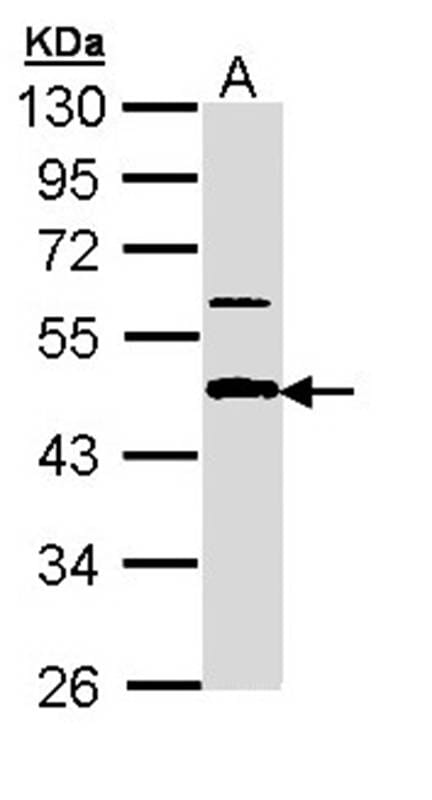 Sample (30 µg of whole cell lysate)  A431 10% SDS PAGE Primary antibody diluted at 1: 1000