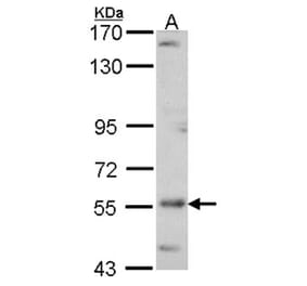 ADCK4 antibody from Signalway Antibody (22680) - Antibodies.com