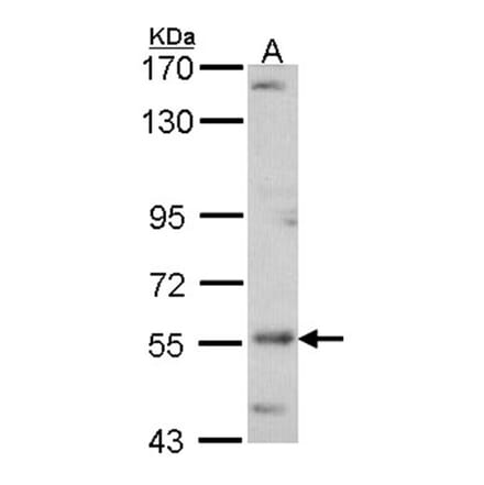 ADCK4 antibody from Signalway Antibody (22680) - Antibodies.com