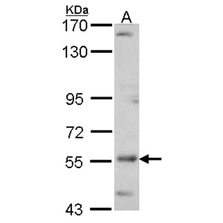 ADCK4 antibody from Signalway Antibody (22680) - Antibodies.com