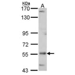 ADCK4 antibody from Signalway Antibody (22680) - Antibodies.com