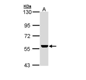 ADCK4 antibody from Signalway Antibody (22681) - Antibodies.com