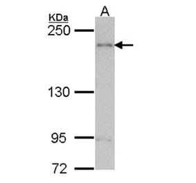 ARAP1 antibody from Signalway Antibody (22701) - Antibodies.com