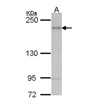 ARAP1 antibody from Signalway Antibody (22701) - Antibodies.com