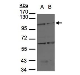 BMPR2 antibody from Signalway Antibody (22704) - Antibodies.com