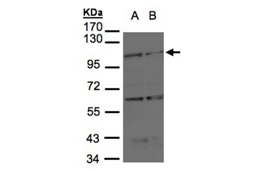 BMPR2 antibody from Signalway Antibody (22704) - Antibodies.com