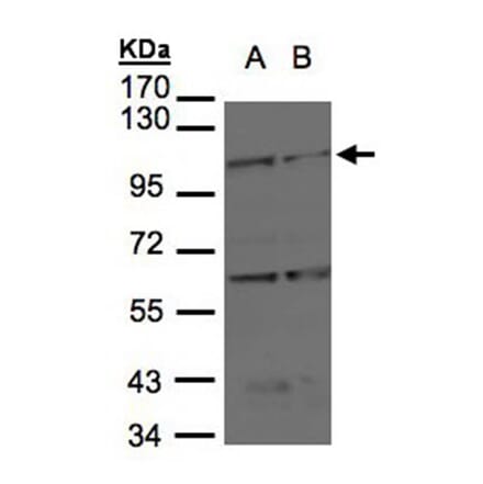 BMPR2 antibody from Signalway Antibody (22704) - Antibodies.com