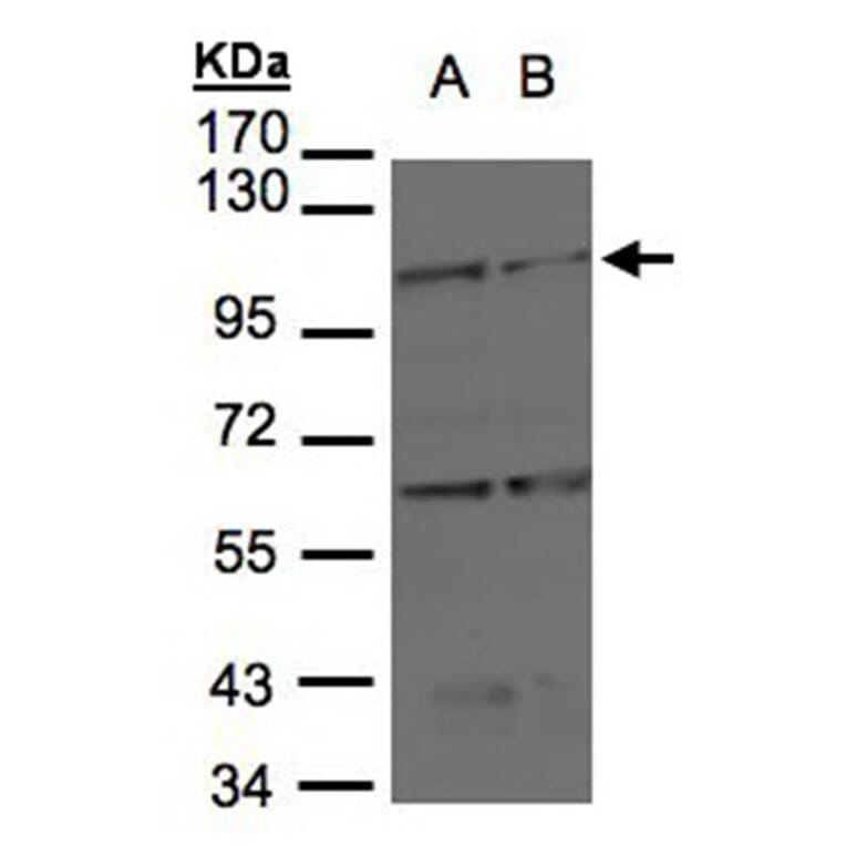 BMPR2 antibody from Signalway Antibody (22704) - Antibodies.com