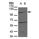 BMPR2 antibody from Signalway Antibody (22704) - Antibodies.com