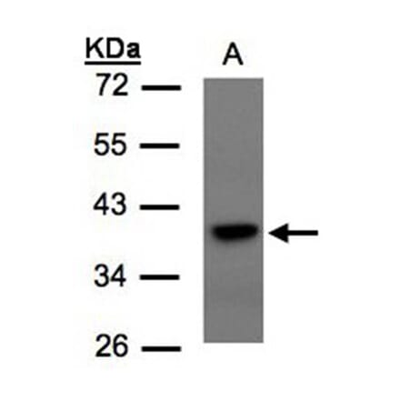 TCF19 antibody from Signalway Antibody (22706) - Antibodies.com