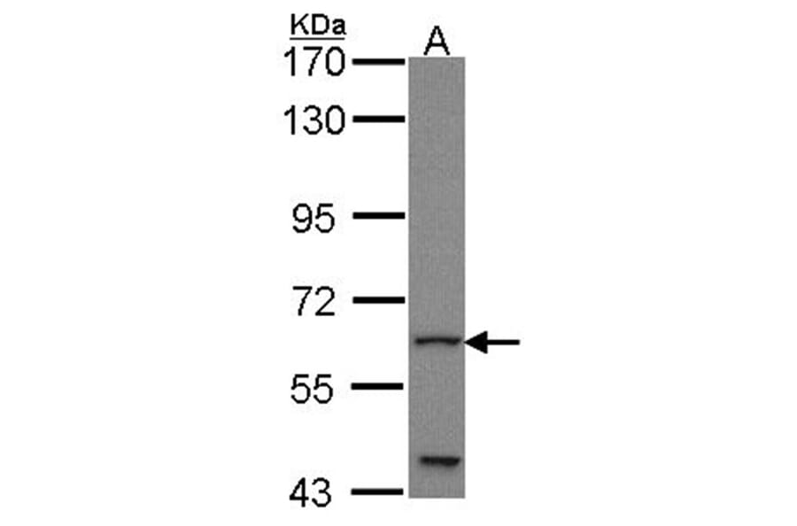 GLIS1 antibody from Signalway Antibody (22714) - Antibodies.com