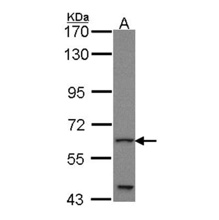 GLIS1 antibody from Signalway Antibody (22714) - Antibodies.com