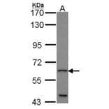 GLIS1 antibody from Signalway Antibody (22714) - Antibodies.com