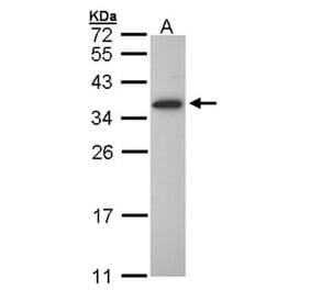 OLIG1 antibody from Signalway Antibody (22763) - Antibodies.com