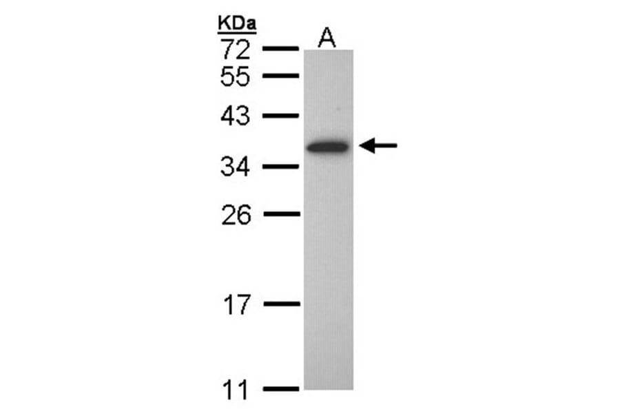 OLIG1 antibody from Signalway Antibody (22763) - Antibodies.com