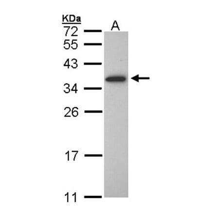 OLIG1 antibody from Signalway Antibody (22763) - Antibodies.com