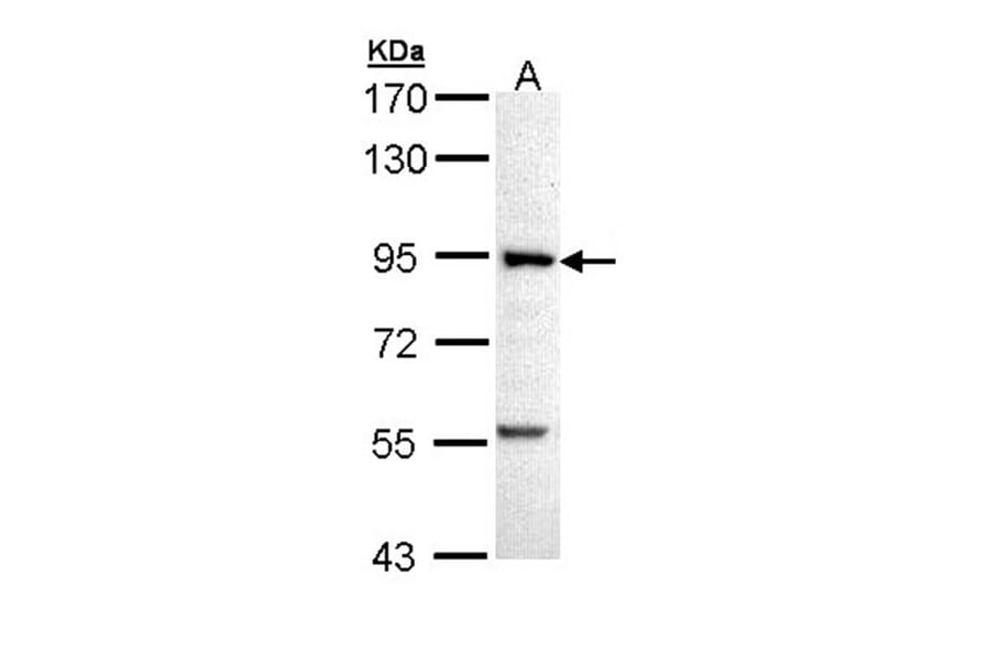 PFK-1 antibody from Signalway Antibody (22772) - Antibodies.com