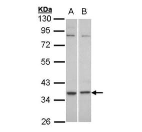 C5L2 antibody from Signalway Antibody (22825) - Antibodies.com