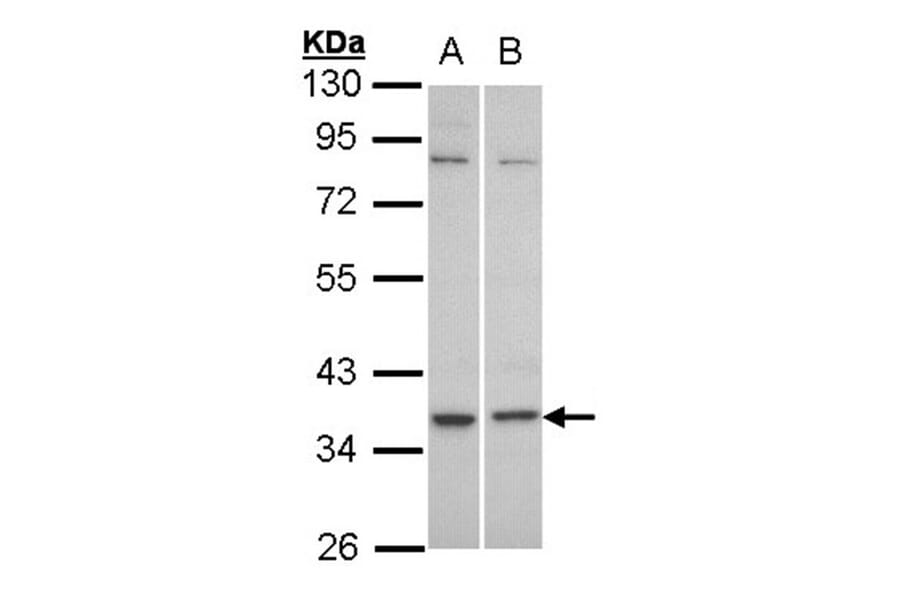 C5L2 antibody from Signalway Antibody (22825) - Antibodies.com