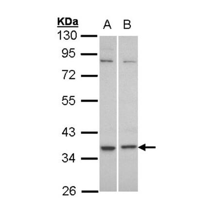 C5L2 antibody from Signalway Antibody (22825) - Antibodies.com