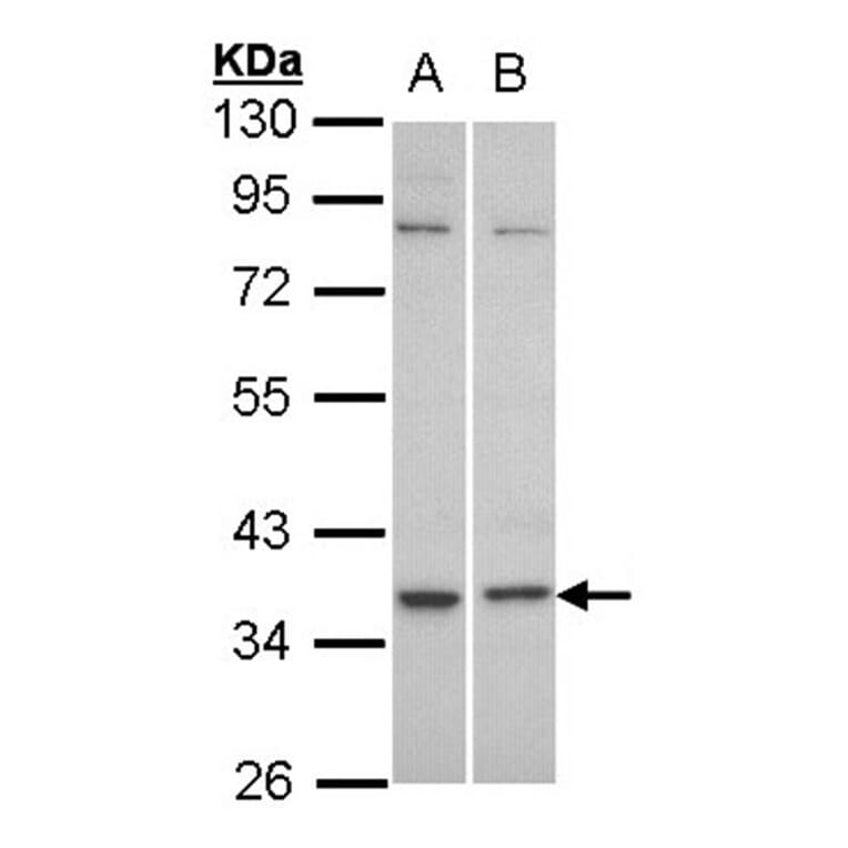 C5L2 antibody from Signalway Antibody (22825) - Antibodies.com