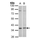 C5L2 antibody from Signalway Antibody (22825) - Antibodies.com
