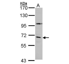 GAD65 antibody from Signalway Antibody (22902) - Antibodies.com