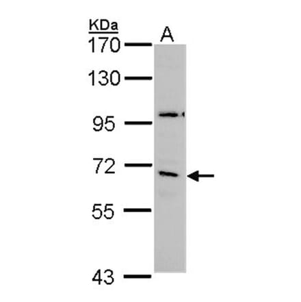 GAD65 antibody from Signalway Antibody (22902) - Antibodies.com