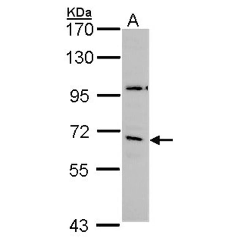 GAD65 antibody from Signalway Antibody (22902) - Antibodies.com