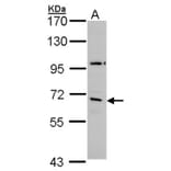 GAD65 antibody from Signalway Antibody (22902) - Antibodies.com